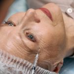 Waarom botox soms echt dé oplossing kan zijn