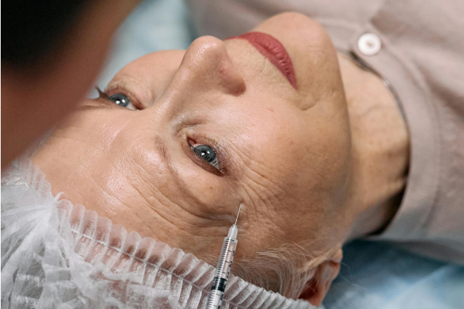 Waarom botox soms echt dé oplossing kan zijn